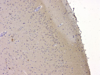 SRCIN1 Rabbit Polyclonal Antibody