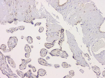 SRCIN1 Rabbit Polyclonal Antibody