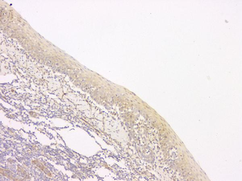 SRCIN1 Rabbit Polyclonal Antibody