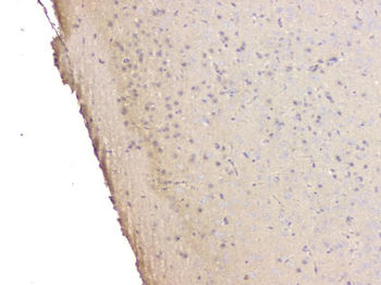 SRCIN1 Rabbit Polyclonal Antibody