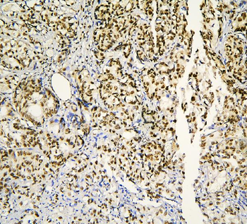BHC80/PHF21A Antibody