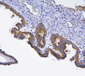 HOOK2 Rabbit Polyclonal Antibody