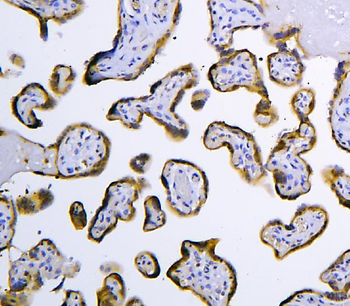HOOK2 Rabbit Polyclonal Antibody