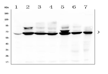 TDRD3 Rabbit Polyclonal Antibody
