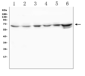 TDRD3 Rabbit Polyclonal Antibody