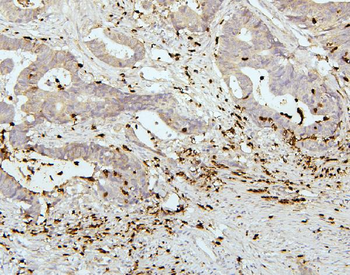 PEF1 Rabbit Polyclonal Antibody