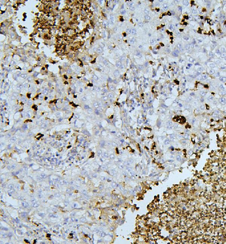 PEF1 Rabbit Polyclonal Antibody