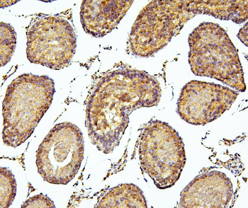 PEF1 Rabbit Polyclonal Antibody