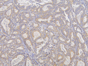 RNF123 Rabbit Polyclonal Antibody