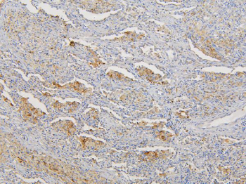 RNF123 Rabbit Polyclonal Antibody