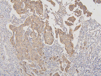 RNF123 Rabbit Polyclonal Antibody