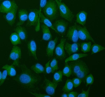 ATP5G1,2,3/ATP5MC1,2,3/ATP5G1 Rabbit Polyclonal Antibody