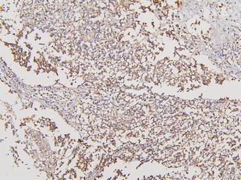 ATP5G1,2,3/ATP5MC1,2,3/ATP5G1 Rabbit Polyclonal Antibody