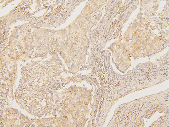 ATP5G1,2,3/ATP5MC1,2,3/ATP5G1 Rabbit Polyclonal Antibody
