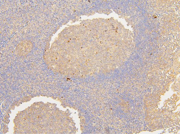 ATP5G1,2,3/ATP5MC1,2,3/ATP5G1 Rabbit Polyclonal Antibody