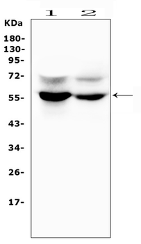 GLUT6/SLC2A6 Rabbit Polyclonal Antibody