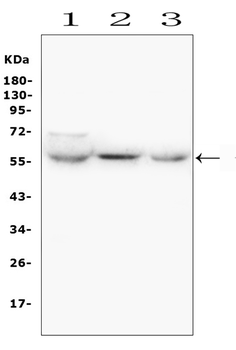 GLUT6/SLC2A6 Rabbit Polyclonal Antibody