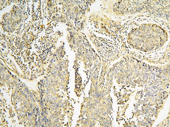 CPAMD8 Rabbit Polyclonal Antibody