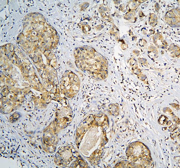 CPAMD8 Rabbit Polyclonal Antibody