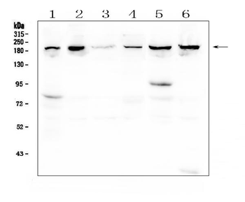CPAMD8 Rabbit Polyclonal Antibody