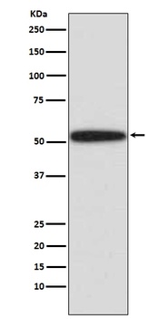 p53 TP53 Rabbit Monoclonal Antibody