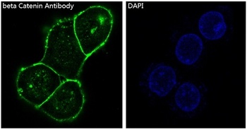 beta Catenin CTNNB1 Rabbit Monoclonal Antibody