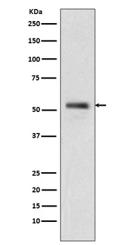PTEN Rabbit Monoclonal Antibody