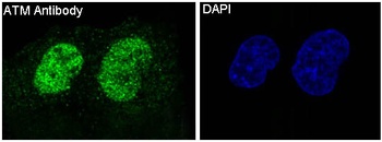 ATM Rabbit Monoclonal Antibody