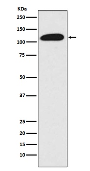 SIRT1 Rabbit Monoclonal Antibody