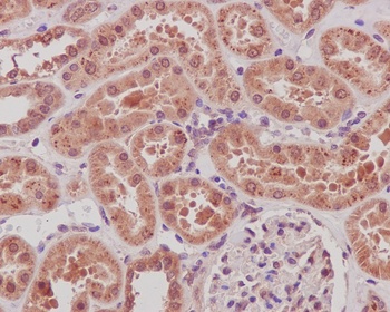 SIRT1 Rabbit Monoclonal Antibody