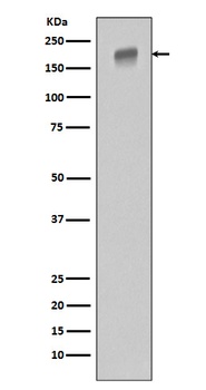EGFR Rabbit Monoclonal Antibody