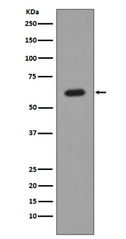AKT1 Monoclonal Antibody