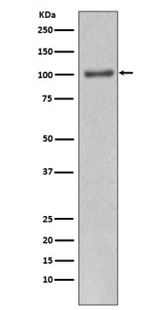 PI 3 kinase p110 alpha Rabbit Monoclonal Antibody