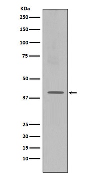 CXCR4 Rabbit Monoclonal Antibody
