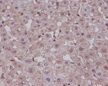 Notch1 Rabbit Monoclonal Antibody