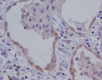 NALP3 NLRP3 Rabbit Monoclonal Antibody