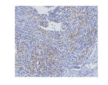 STAT1 Mouse Monoclonal Antibody