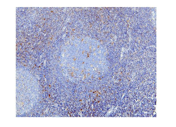 STAT1 Mouse Monoclonal Antibody