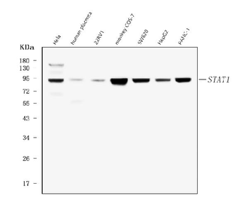 STAT1 Mouse Monoclonal Antibody