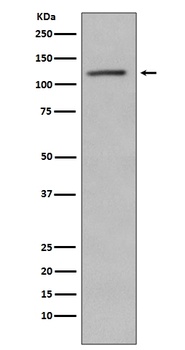 Phospho-Retinoblastoma RB1 Rabbit Monoclonal Antibody