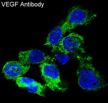 VEGF VEGFA Rabbit Monoclonal Antibody