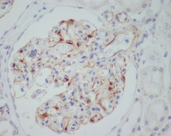 VEGF VEGFA Rabbit Monoclonal Antibody