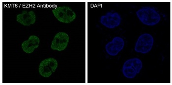 KMT6/EZH2 Rabbit Monoclonal Antibody