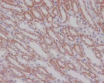 Smad3 Rabbit Monoclonal Antibody