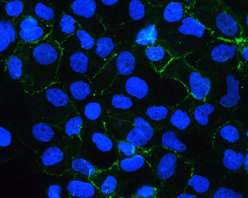 E Cadherin 1 CDH1 Antibody (monoclonal, 9G2)