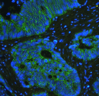 E Cadherin 1 CDH1 Antibody (monoclonal, 9G2)