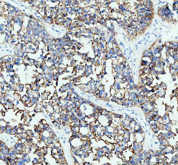 E Cadherin 1 CDH1 Antibody (monoclonal, 9G2)