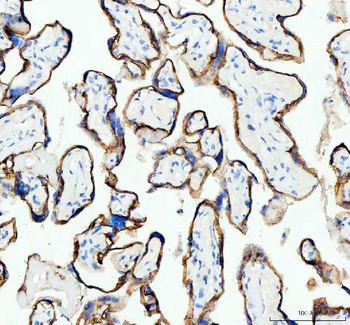 E Cadherin 1 CDH1 Antibody (monoclonal, 9G2)