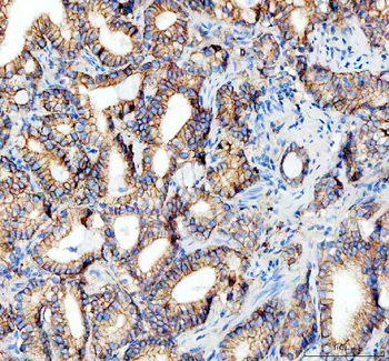 E Cadherin 1 CDH1 Antibody (monoclonal, 9G2)