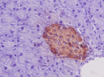 Insulin Rabbit Monoclonal Antibody